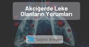 Akciğerde Nodül Olanların Yorumları: Sağlık Sürecine Dair Paylaşımlar