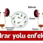 Antibiyotiğe Rağmen Geçmeyen İdrar Yolu Enfeksiyonu: Nedenleri ve Çözümleri