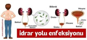 Antibiyotiğe Rağmen Geçmeyen İdrar Yolu Enfeksiyonu: Nedenleri ve Çözümleri