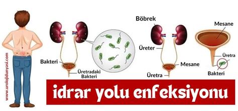 Antibiyotiğe Rağmen Geçmeyen İdrar Yolu Enfeksiyonu: Nedenleri ve Çözümleri