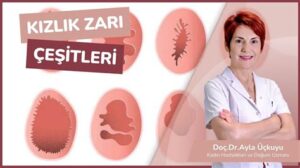 Bozulmamış Kızlık Zarı Belirtileri: Bilmeniz Gerekenler
