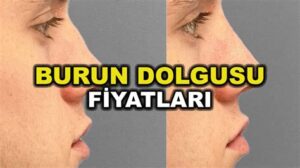 Burun Dolgusu Fiyatları: 2023 İçin Bilgilendirme