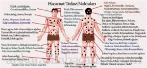 Hacamat Noktaları: Geleneksel Tedavi Yöntemleri ve Faydaları