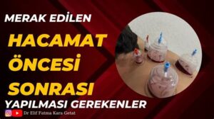 Hacamat Sonrası: Dikkat Edilmesi Gerekenler