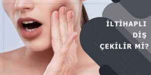 İltihaplı Diş Çekilir Mi? Uzmanların Cevapları
