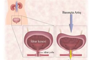 Kadın İdrar Deliği Resmi: Anatomik Bilgiler ve Sağlık Üzerine