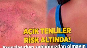 Kuru Sıkılar: Nedenleri ve Tedavi Yöntemleri
