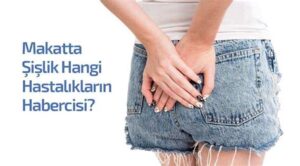 Makatta Şişlik: Belirtiler ve Tedavi Yöntemleri (Resimli)