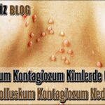 Molluskum Kontagiozum: Belirtileri ve Tedavi Yöntemleri