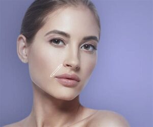 Nazolabial Dolgu: Anında Gençlik ve Estetik Çözümler