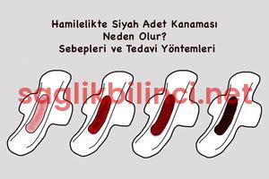 Siyah Çamurumsu Adet Kanaması: Sağlık Göstergeleri Nelerdir?
