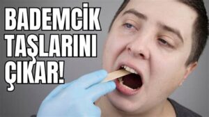 Sonda Nasıl Çıkarılır? Adım Adım Rehber