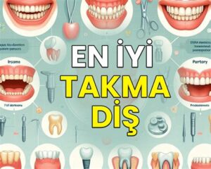 Takma Diş: Seçenekler ve Kullanım İpuçları